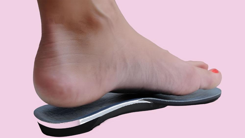 ارتز برای درمان قوس زیاد کف پا