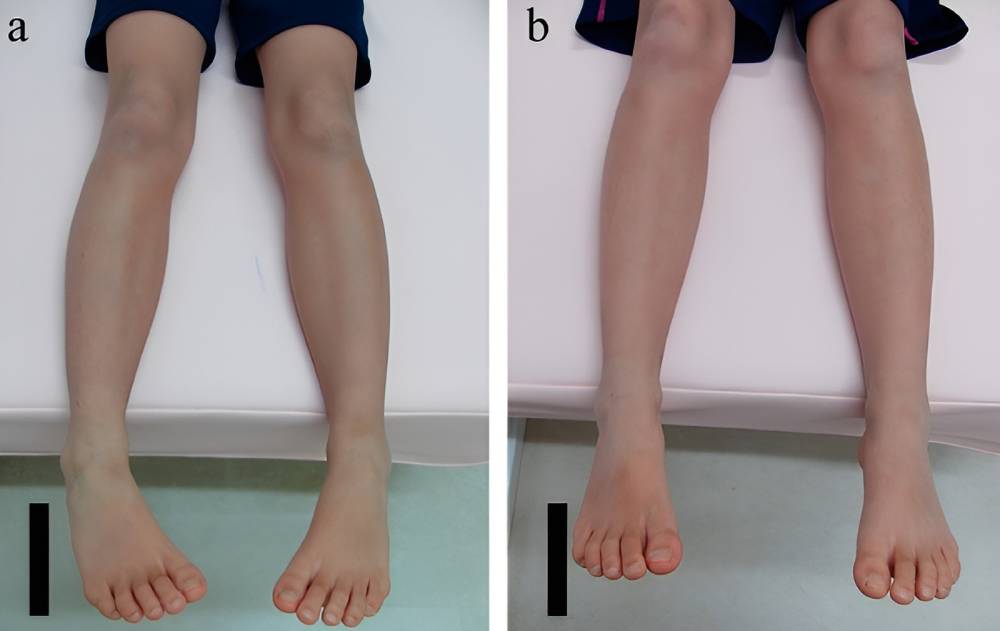 چرخش ساق پا