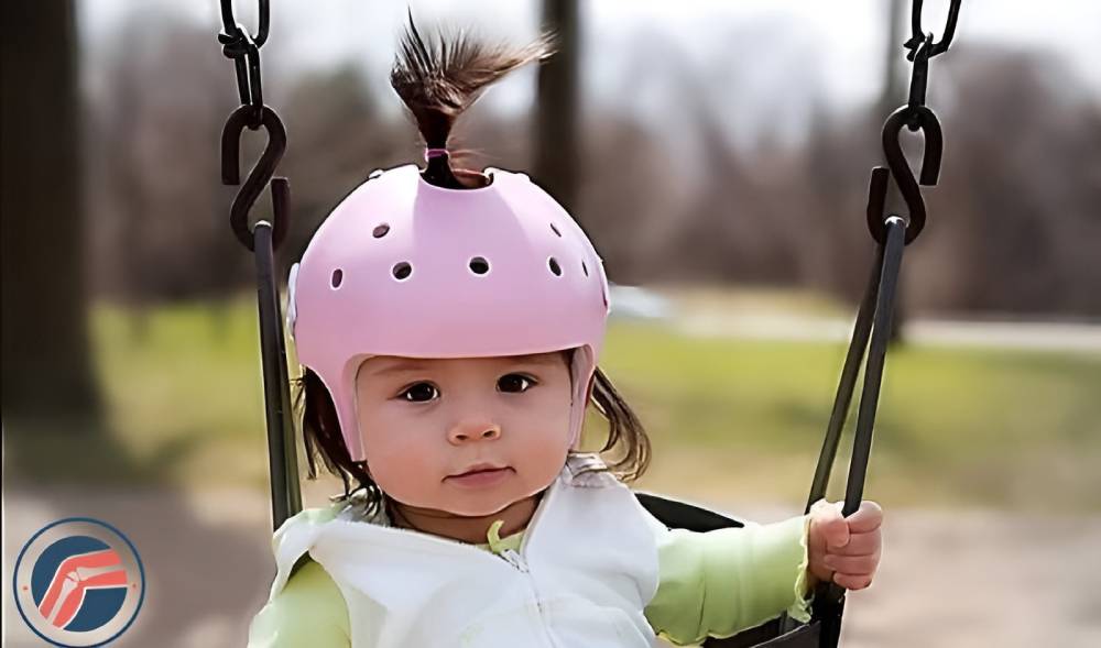 کلاه اصلاح بدشکلی جمجمه