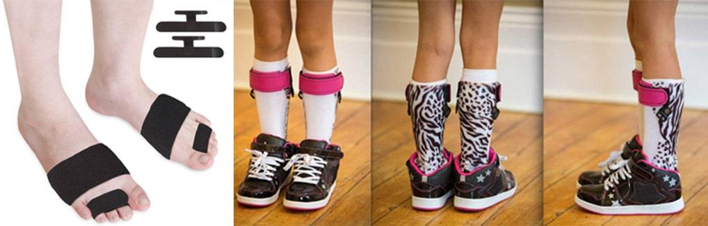 استفاده از ارتزهای پا برای درمان راه رفتن روی پنجه پا