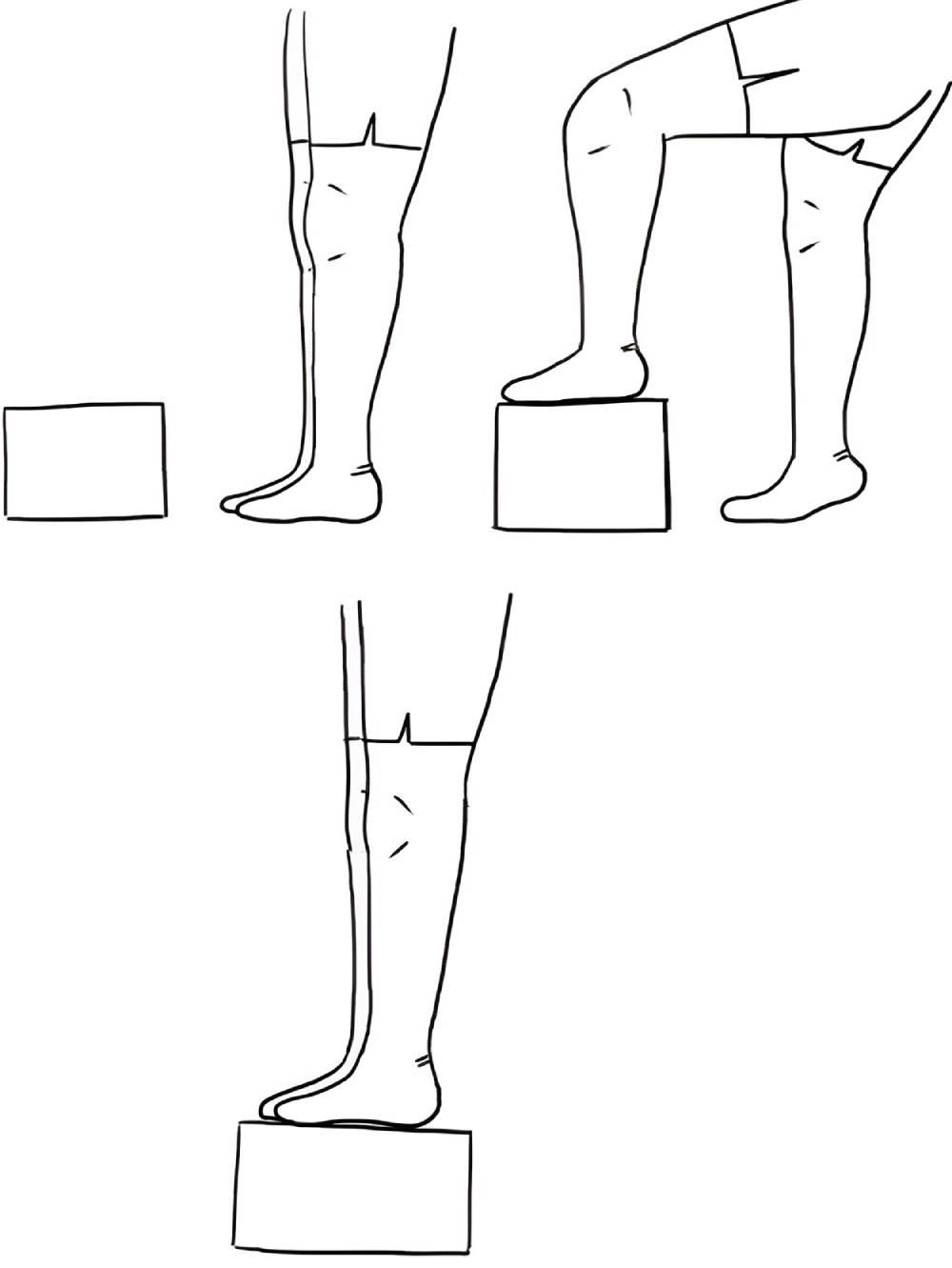 تمرین استپ آپ برای درمان عقب‌زدگی زانو