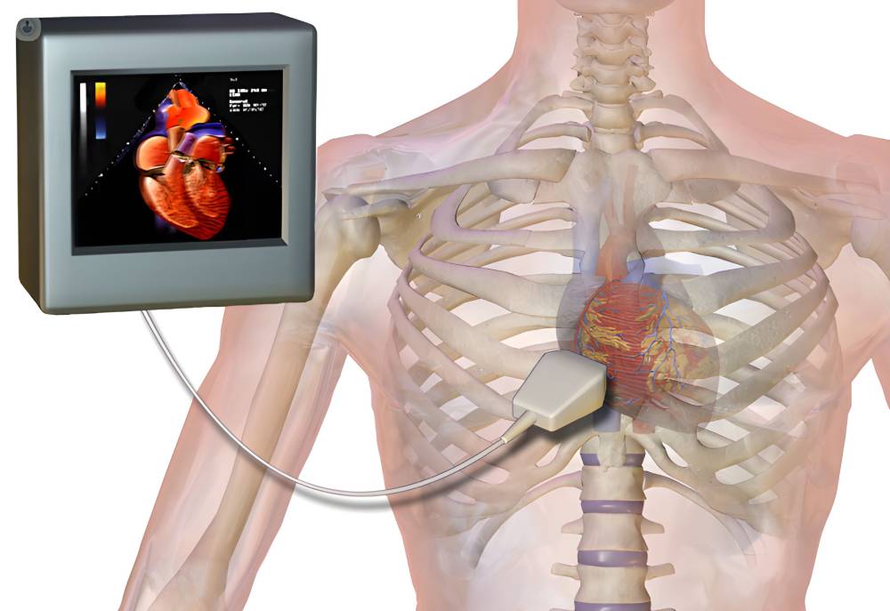 اکوی قلب (اکوکاردیوگرام) برای تشخیص سینه کبوتری