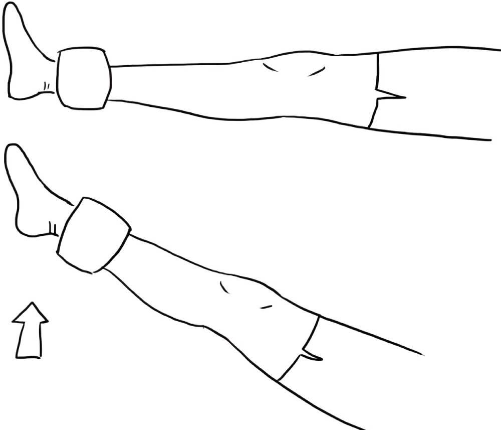تمرین بالاآوردن پا برای درمان عقب‌زدگی زانو