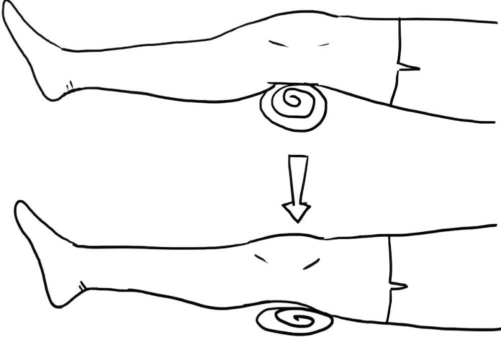 تقویت ایزومتریک عضلات چهارسر برای درمان عقب‌زدگی زانو