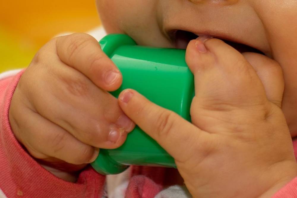 سینداکتیلی یا چسبندگی انگشت در کودکان چیست؟