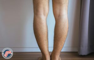 پای پرانتزی خفیف