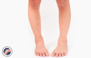 پای پرانتزی متوسط